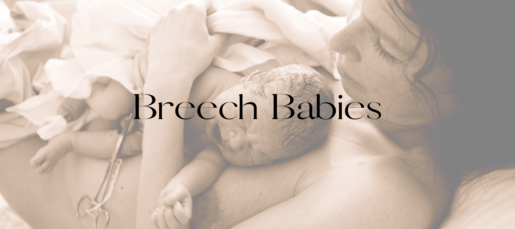 Breech Babies