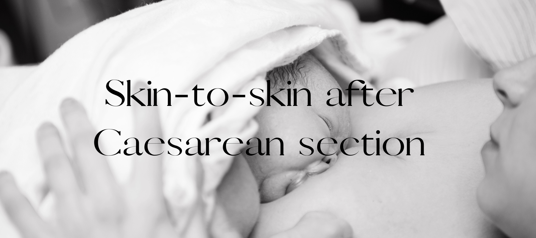 Skin to Skin after Caesarean Section