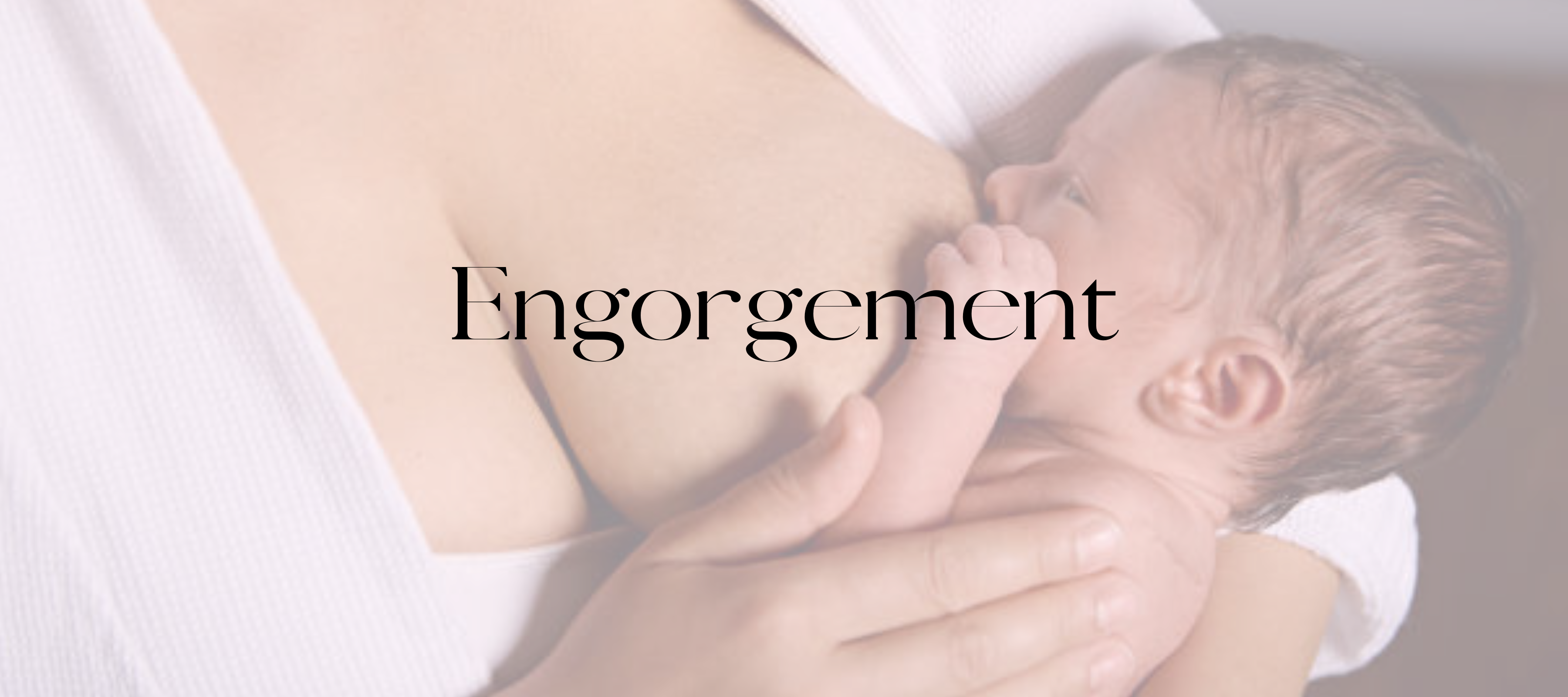 Breast Engorgement