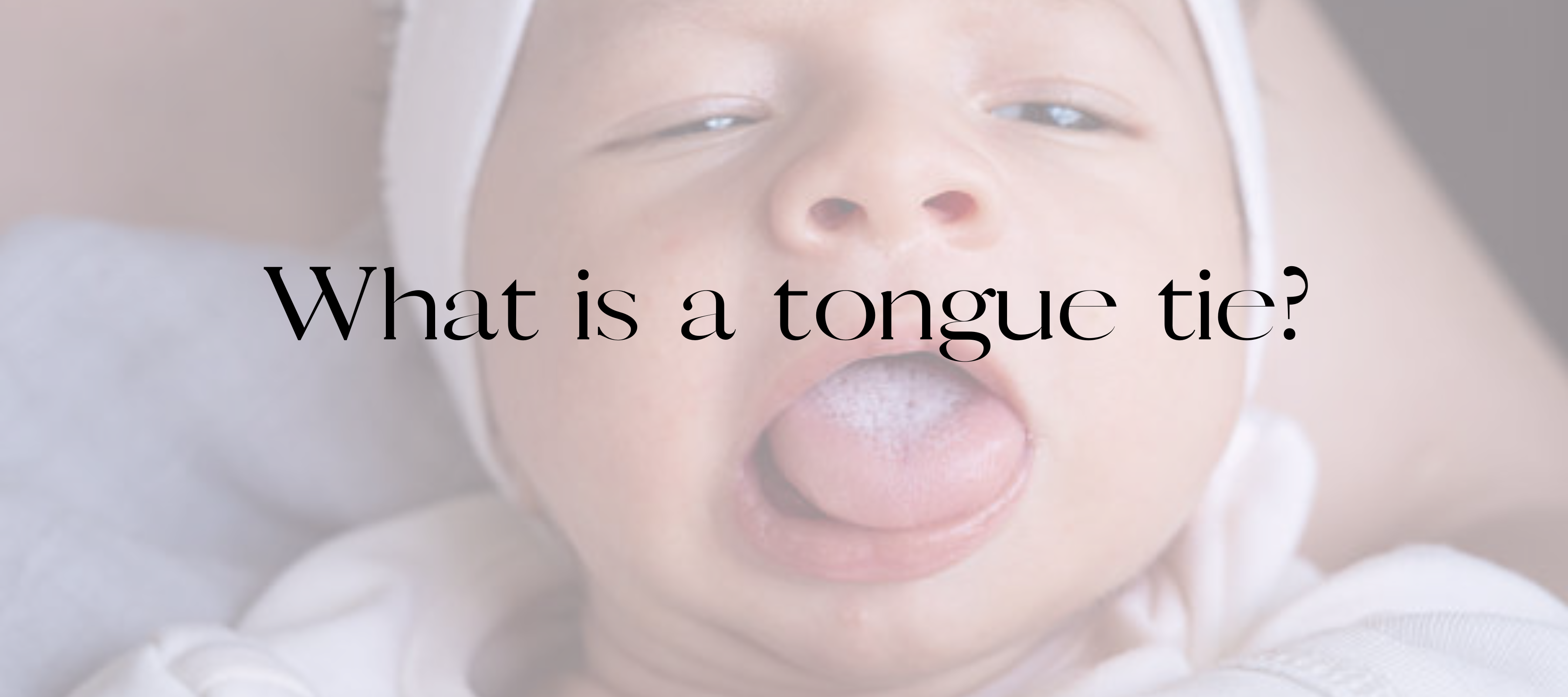 What is a Tongue Tie?